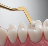White Filling